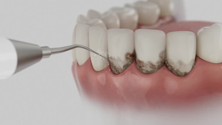 Reliable Root Canal Treatment contractor in Carver County County, MN by Dentist Open Now